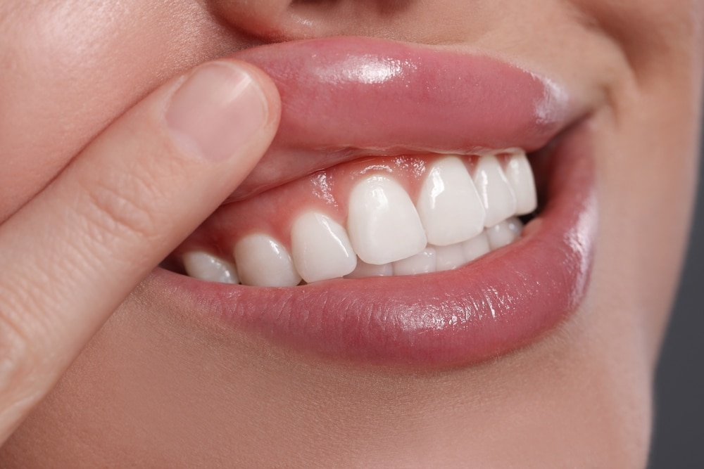 Young,Woman,Showing,Healthy,Gums,,Closeup,View